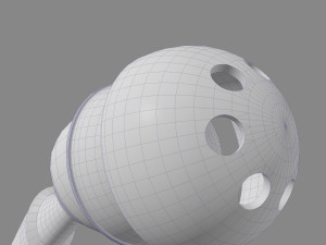 Hip Replacement 3D Model