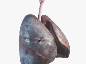 Smokers Lungs Modelo 3D