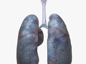 Pulm&otilde;es de fumantes Modelo 3D