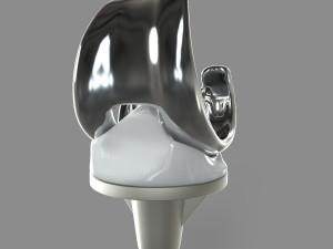 Knee Replacement Modelo 3D