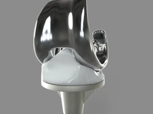 Knee Replacement 3D Model