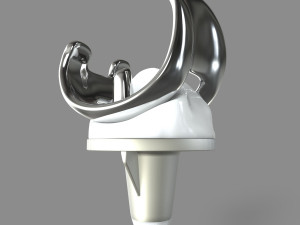 Knee Replacement Modelo 3D