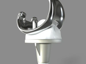 Knee Replacement 3D Model
