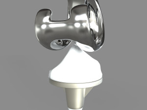 Knee Replacement Modelo 3D