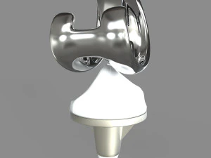 Knee Replacement 3D Model
