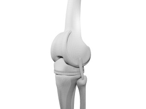 Knee Replacement Modelo 3D