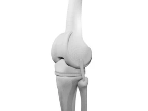 Knee Replacement 3D Model
