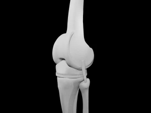 Knee Replacement 3D Model