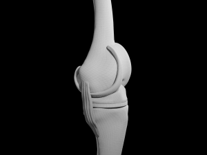 Knee Replacement Modelo 3D
