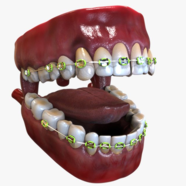 Mouth with Braces 3D Model .c4d .max .obj .3ds .fbx .stl .blend 