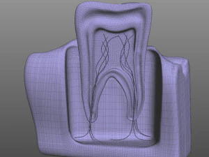 Tooth Anatomy 3D Model