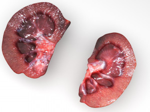 Kidney Section Model 3D