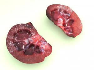 Kidney Section 3D Model