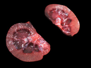 Kidney Section Model 3D