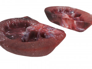 Kidney Section Model 3D