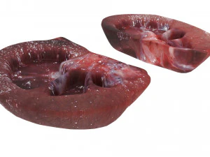 Kidney Section 3D Model