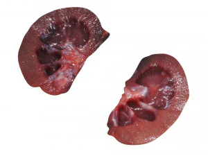 Kidney Section 3D Model