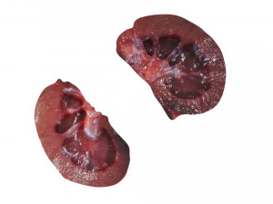 Kidney Section 3D Model