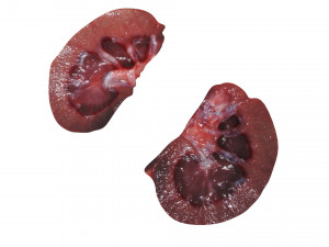 Kidney Section Model 3D