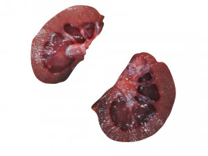 Kidney Section 3D Model