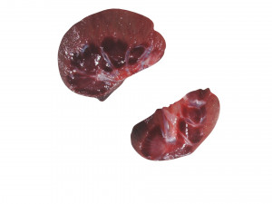 Kidney Section Model 3D