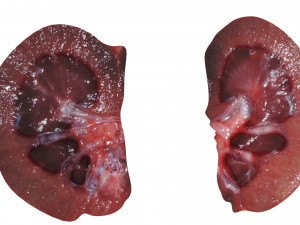 Kidney Section Model 3D