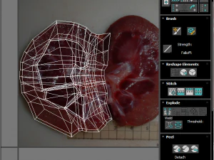 Kidney Section 3D Model