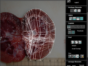 Kidney Section Model 3D