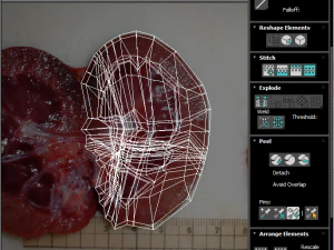 Kidney Section 3D Model