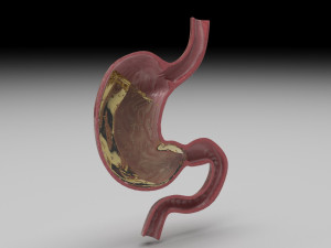 Gastric Acid In Stomach 3D Model