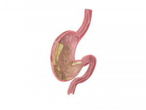 Gastric Acid In Stomach 3D Model