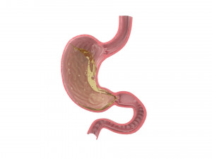Gastric Acid In Stomach 3D Model