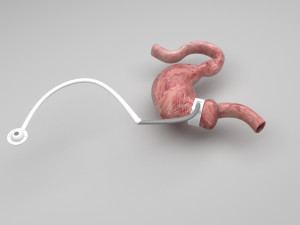 Stomach With Stomach Band 3D Model