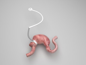 Stomach With Stomach Band 3D Model