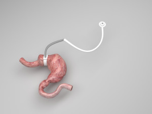 Stomach With Stomach Band 3D Model