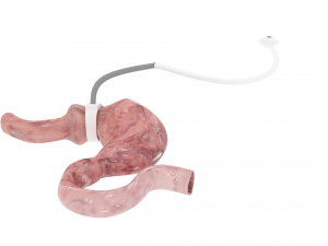 Stomach With Stomach Band 3D Model