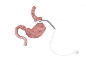 Stomach With Stomach Band 3D Model