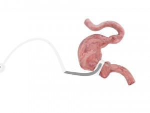Stomach With Stomach Band 3D Model