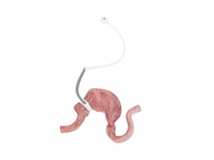 Stomach With Stomach Band 3D Model
