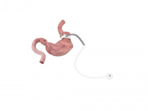 Stomach With Stomach Band 3D Model