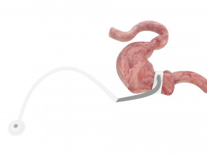 Stomach With Stomach Band 3D Model