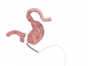 Stomach With Stomach Band 3D Model