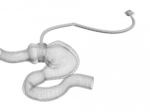 Stomach With Stomach Band 3D Model