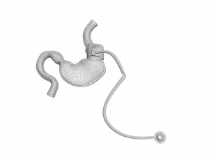Stomach With Stomach Band 3D Model