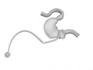 Stomach With Stomach Band 3D Model