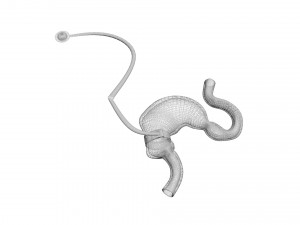 Stomach With Stomach Band 3D Model