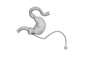 Stomach With Stomach Band 3D Model