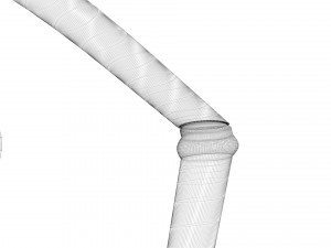 Stomach With Stomach Band 3D Model