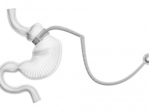 Stomach With Stomach Band 3D Model