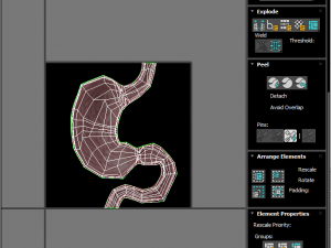 Stomach With Stomach Band 3D Model